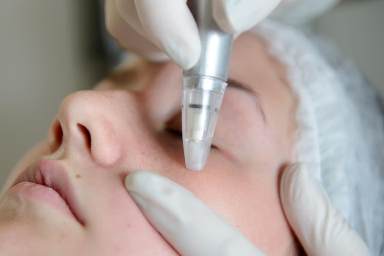 Skin treatment with a fine hand-held applicator